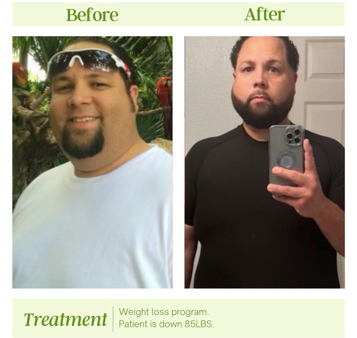 Before — The Starting Point