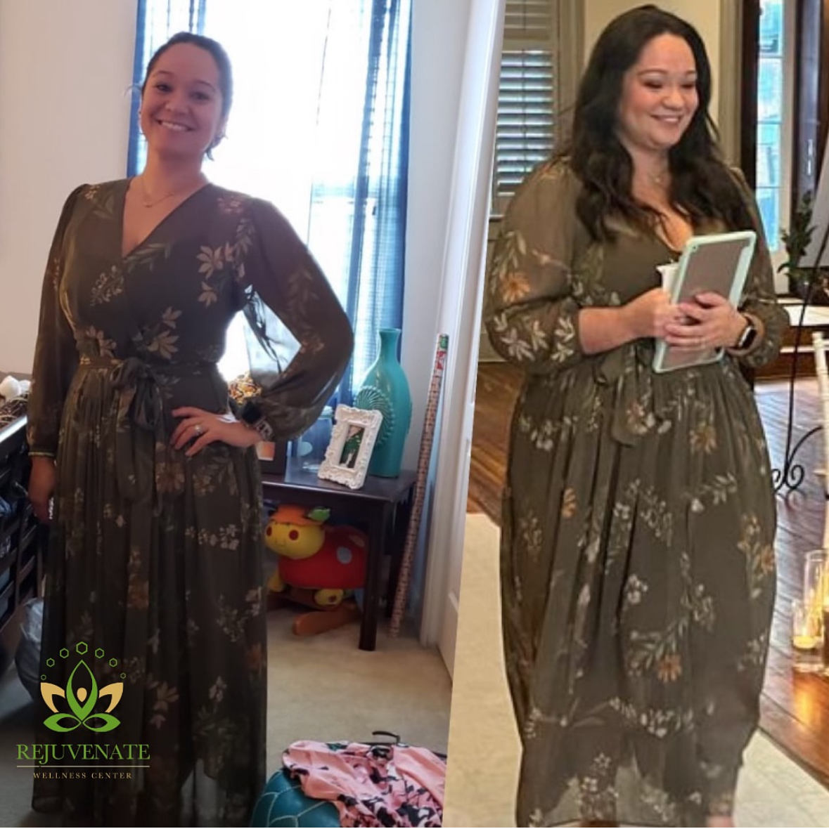 Before — The Starting Point